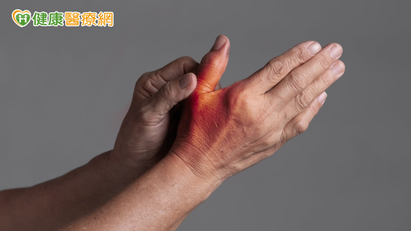 大拇指痛到無法拿鍋鏟 &nbsp;竟是「拇指腕掌關節炎」惹禍