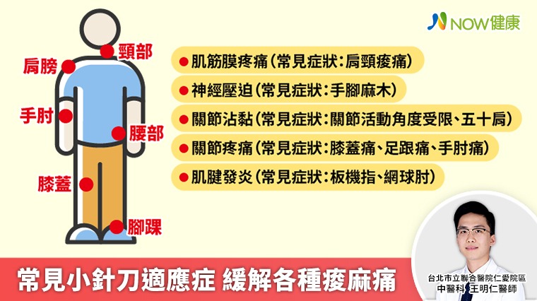 3C產品導致頸椎病年輕化 中醫小針刀緩解各種痠麻痛