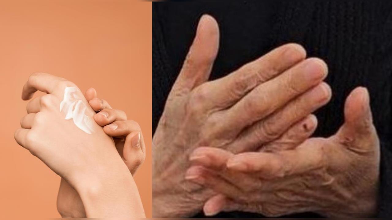 74歲婦「擦藥擦到洗腎」？醫點名外用藥「1成分」過量恐滲入腎臟！