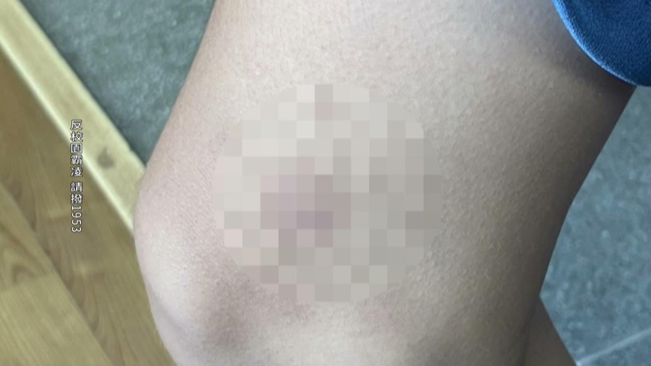 特教師涉長期霸凌學生　受害家長：校方刻意袒護