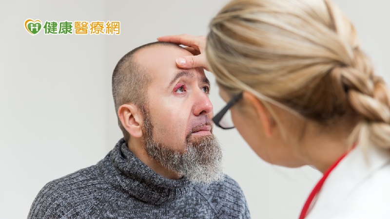 長針眼會傳染嗎？　不會！醫破除３迷思