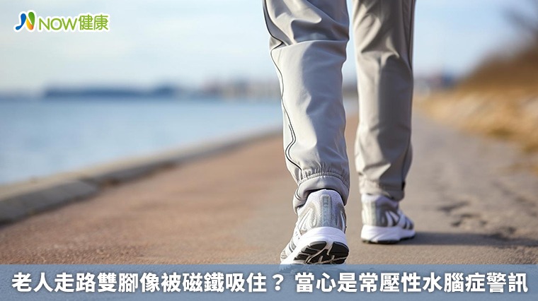 老人走路雙腳像被磁鐵吸住? 當心是常壓性水腦症警訊