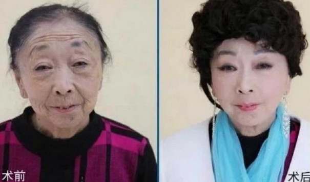 58歲阿嬤嫁給26歲天菜小鮮肉 　把自己整成30歲少婦卻悲劇收場