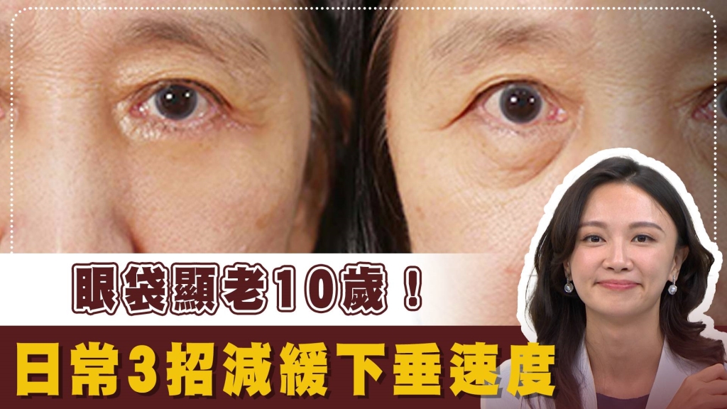 不想動刀也能告別「垂墜熊貓眼」?醫揭「3招回春」眼袋可能還有救!