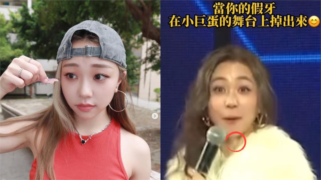 蕭敬騰師妹「假牙掉在小巨蛋」心都碎了！拍片自嘲「真厲害」300萬人笑瘋