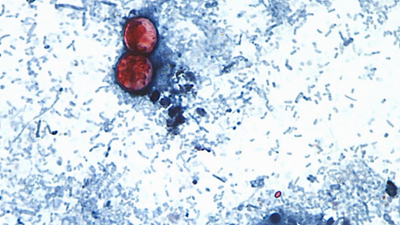 美國驚爆「新疫情」破萬人確診、罕見奪2命！感染源頭指向進口「1食物」