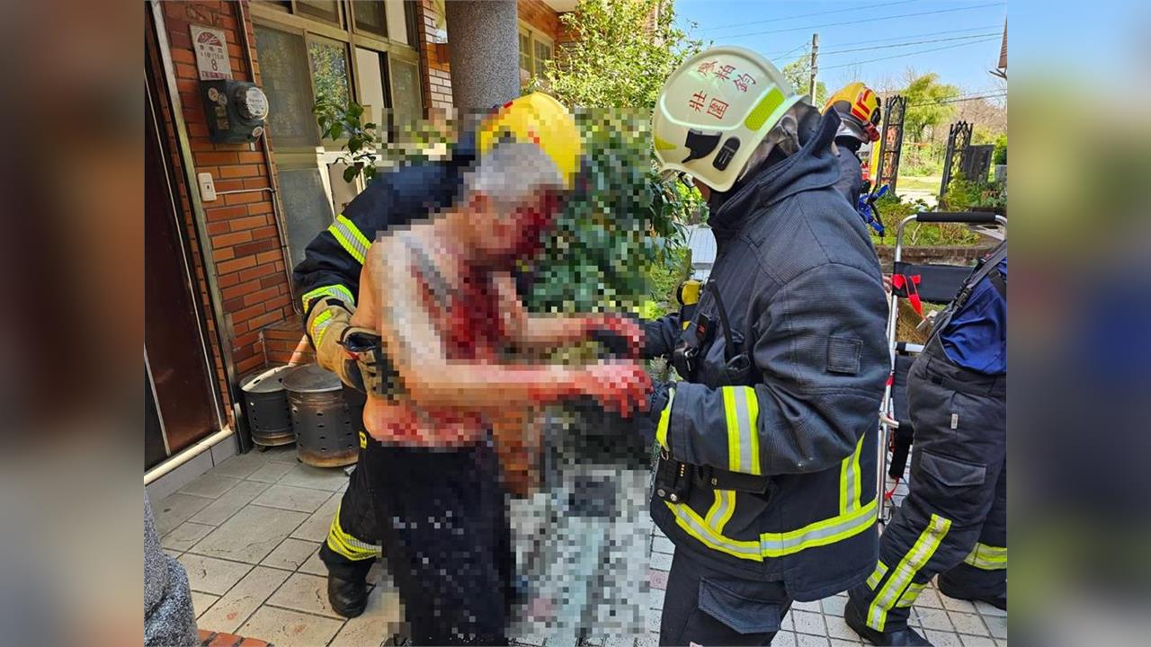 快新聞／宜蘭民宅爆炸案！姊弟全身血急送醫　打開包裹原因曝光