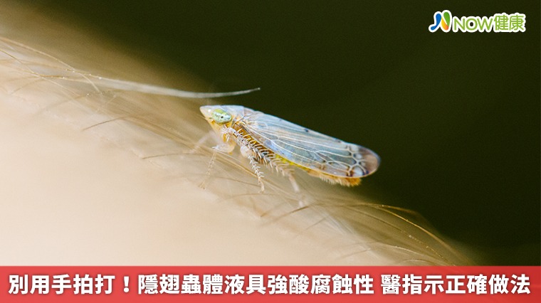 別用手拍打！隱翅蟲體液具強酸腐蝕性　醫指示正確做法
