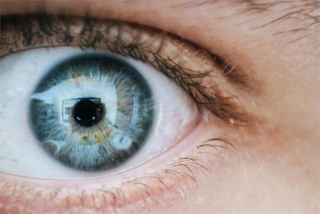 冬天「眼乾」好困擾！   生活中5種小因素恐加劇