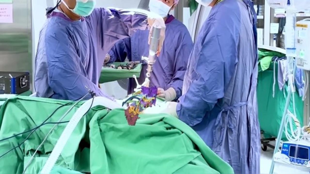 台中榮總傳「讓無照廠商動刀」！醫師納涼喊「會痛要講」受害者破180人