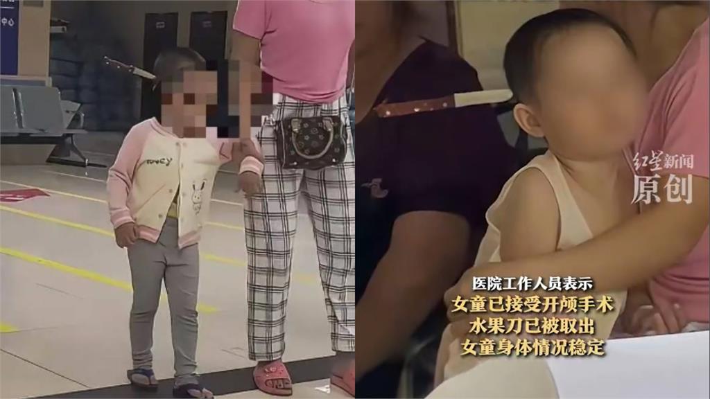 中國女童「頭插水果刀」進醫院不哭不鬧 網見畫面批:家長讓她自己走?