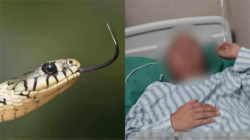 男想護眼吞蛇膽⋯一看「眼前全上馬賽克」!竟從腦袋取出18公分寄生蟲