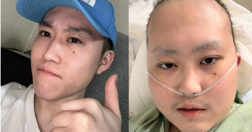 21歲YouTuber罹罕見骨癌撐4年　才拍下「人生最後治療」！家屬悲痛證實死訊