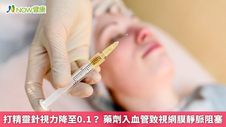 打精靈針視力降至0.1？ 藥劑入血管致視網膜靜脈阻塞