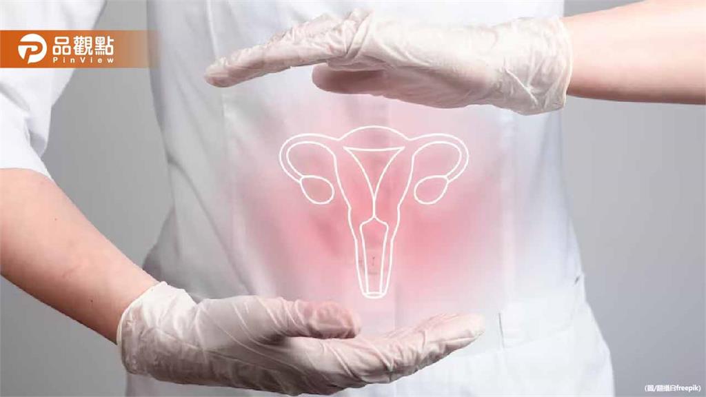 結紮「能降低卵巢癌風險？」　婦產科醫這樣說