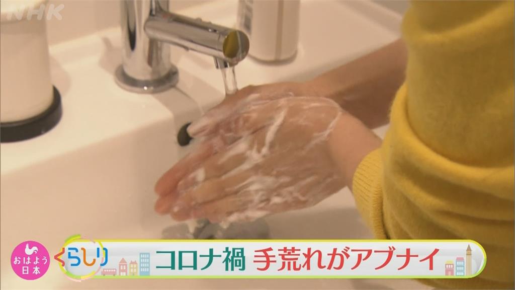 用力防疫狂洗手  破皮乾裂易積菌！保養雙手  日本專家有撇步