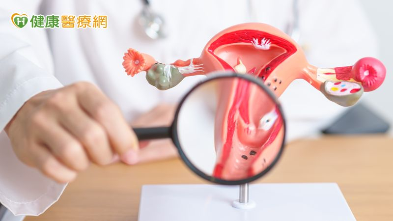 台灣迎戰「世界消除子宮頸癌日」　篩檢下修至25歲＋3措施升級防護