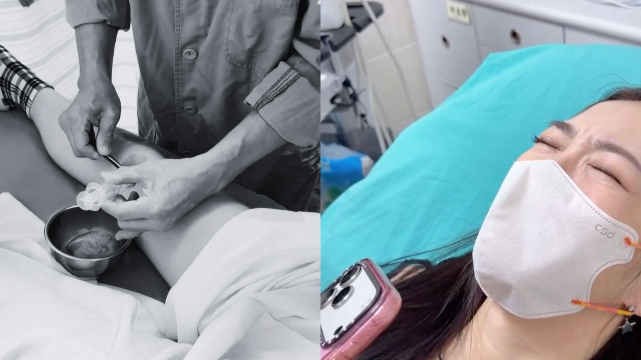 驚悚畫面！女明星前十字韌帶撕裂送急診　「超粗針頭」扎入淚喊：我可以叫嗎？