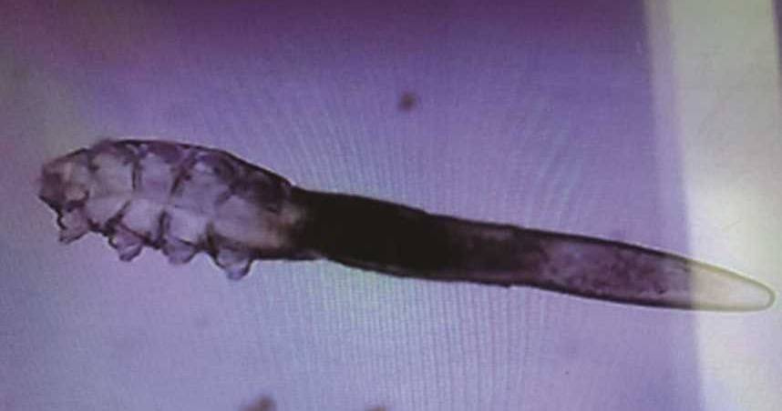 涼蓆3個月沒用　女睡醒「全身紅斑」癢爆！醫示警：每張藏千萬隻蟎蟲