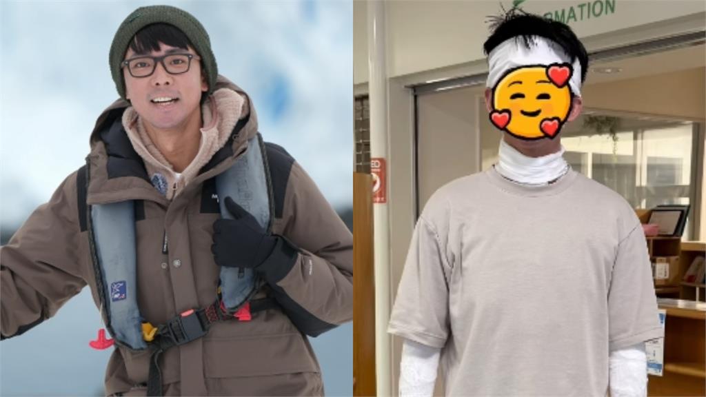阿滴赴日「治療35年隱疾」！全身白布包紮「像木乃伊」親揭最新病況