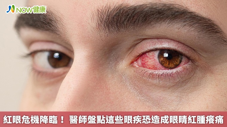 紅眼危機降臨！ 醫師盤點這些眼疾恐造成眼睛紅腫癢痛