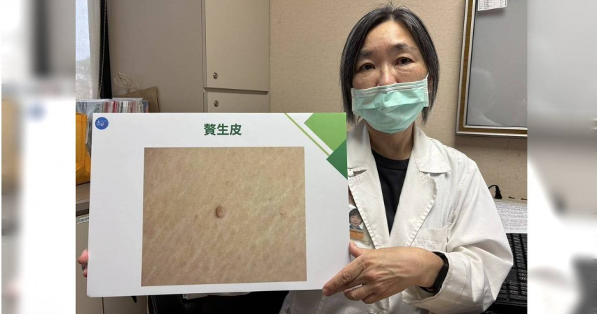 43歲女腹股溝長「吊鐘狀腫塊」磨到發炎　醫：嚴重恐壞死！3族群風險高