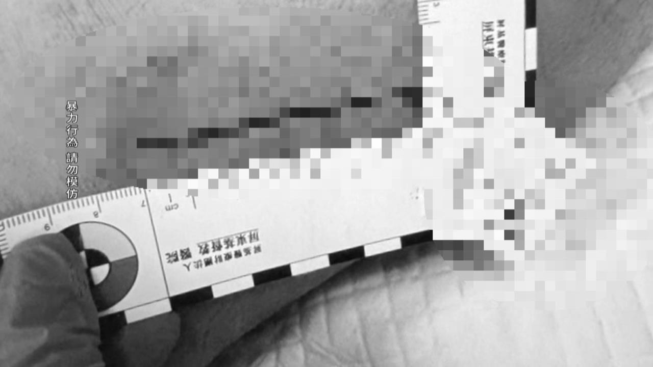 國中生爭執持美工刀攻擊　同學小腿遭劃傷八公分家長怒提告