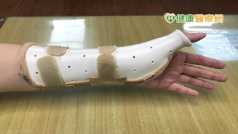 復健配戴副木是為什麼？ 職能治療師說明用途