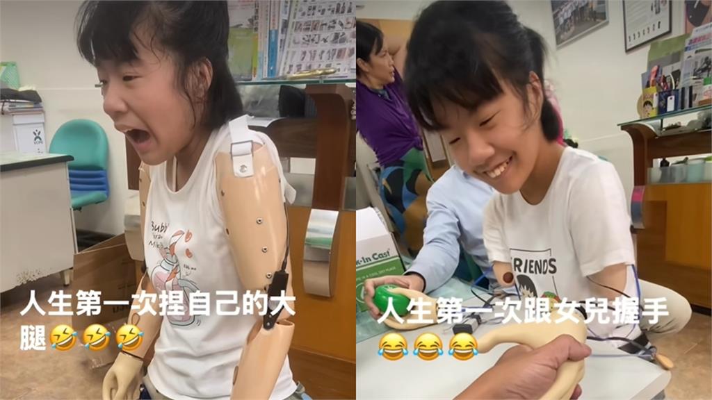 「單腳天使」徐又立裝義肢「首次與爸爸握手」畫面曝!父感動:等了12年