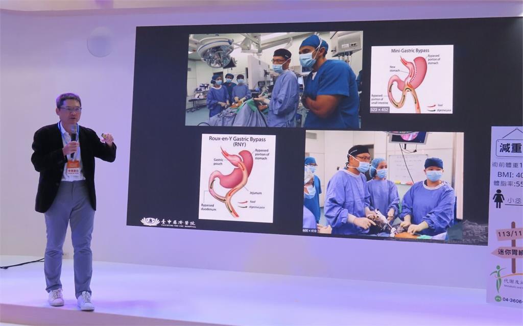 男胖到135公斤險沒命! 胃縮小甩49公斤解除「換心危機」