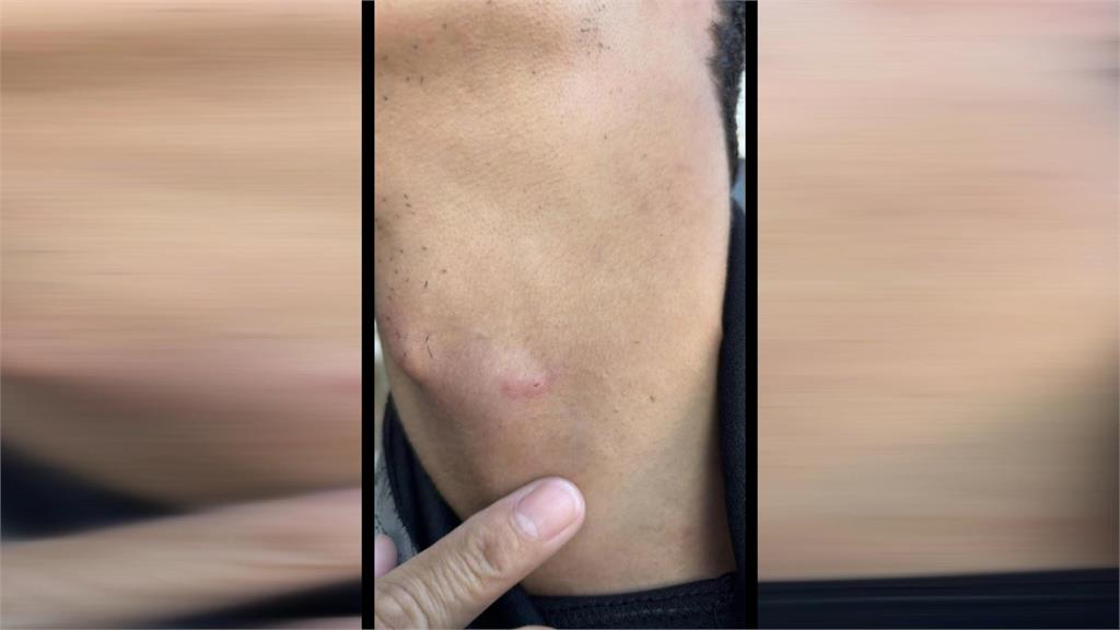 釣到潛水客？教練爆遭漁船魚鉤鉤傷脖　籲政府速劃定界線