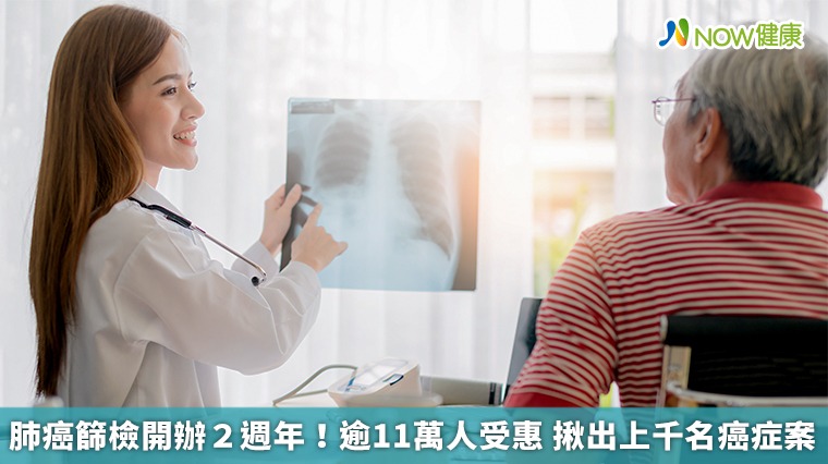 肺癌篩檢開辦2週年！逾11萬人受惠　揪出上千名癌症案