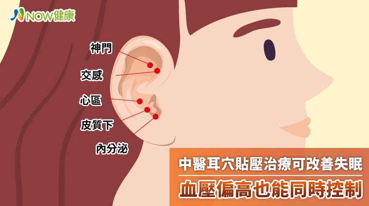 中醫耳穴貼壓治療可改善失眠 血壓偏高也能同時控制