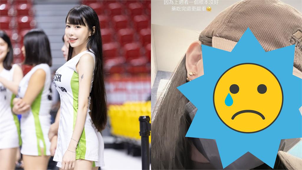 啦啦隊女神梓梓健康亮紅燈！生病1周「藥吃完更嚴重」憔悴模樣曝