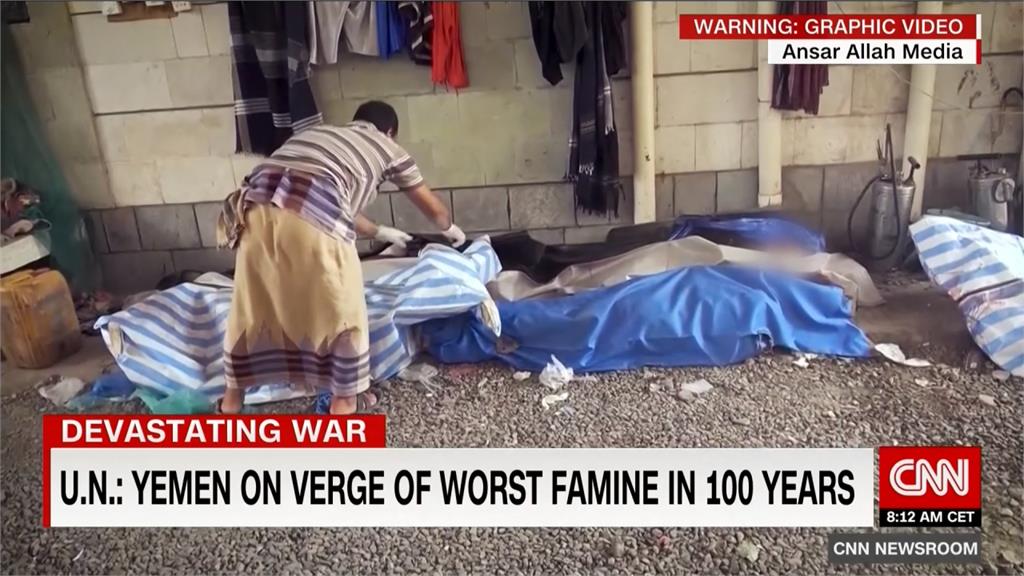 葉門內戰民不聊生 再爆百年最嚴重饑荒
