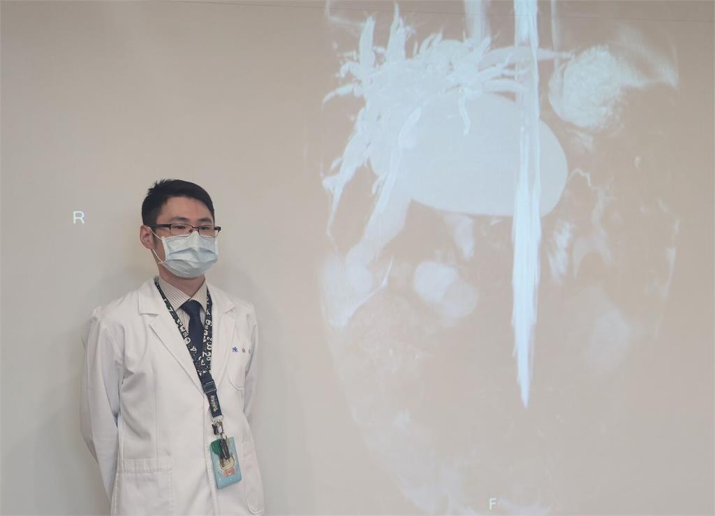 家長留意！1歲童腹脹嘔吐3天   罕見「先天性膽管囊腫」增癌風險