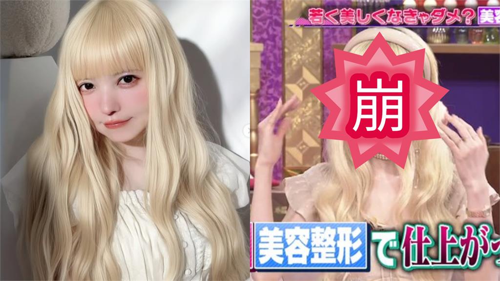 日本「洋娃娃系」名模昔追V臉瘋狂醫美！「溶解玻尿酸」整臉爆改驚人樣貌曝