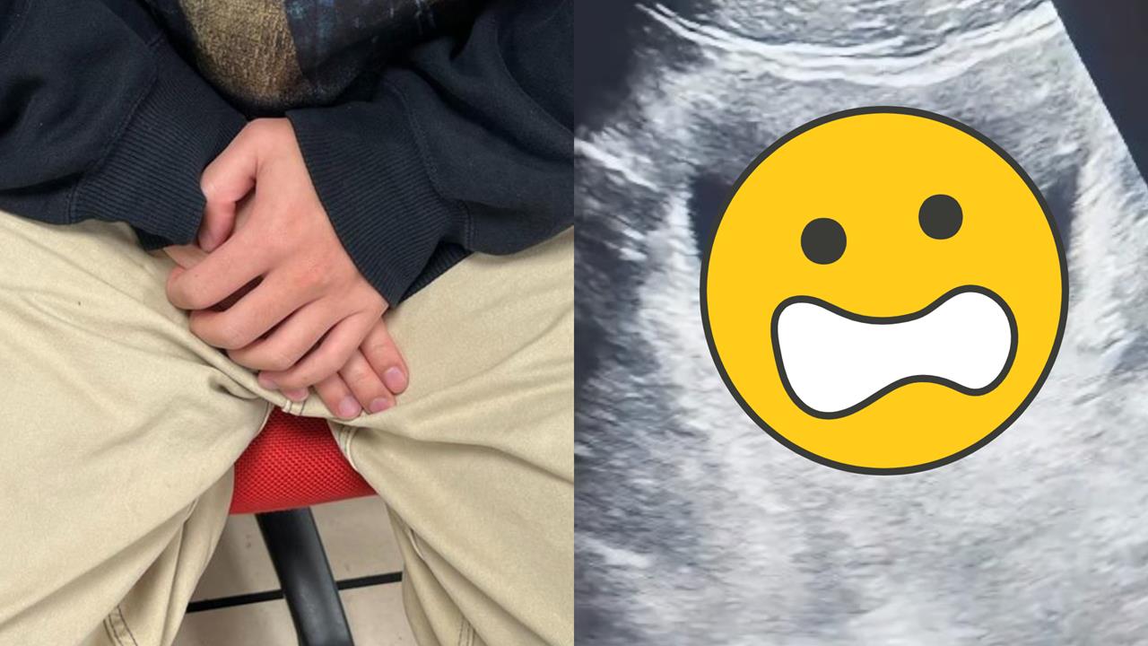 為追求「奇特效果」竟將活體生物塞下面！他下秒「劇痛、尿不出來」急衝醫院