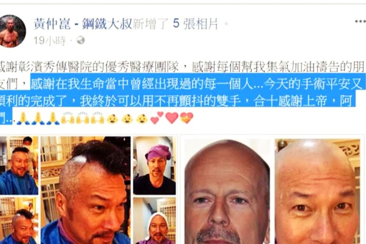 手抖20年 黃仲崑手術成功PO照報喜