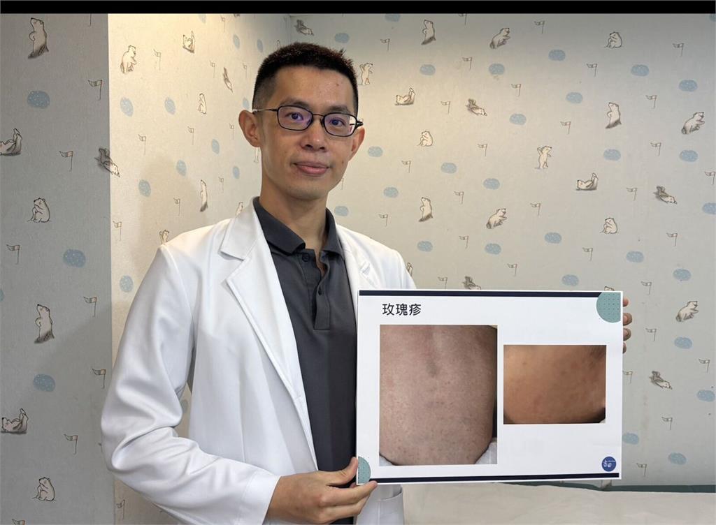 小小孩反覆高燒39、40度   若併「一症狀」小心玫瑰疹