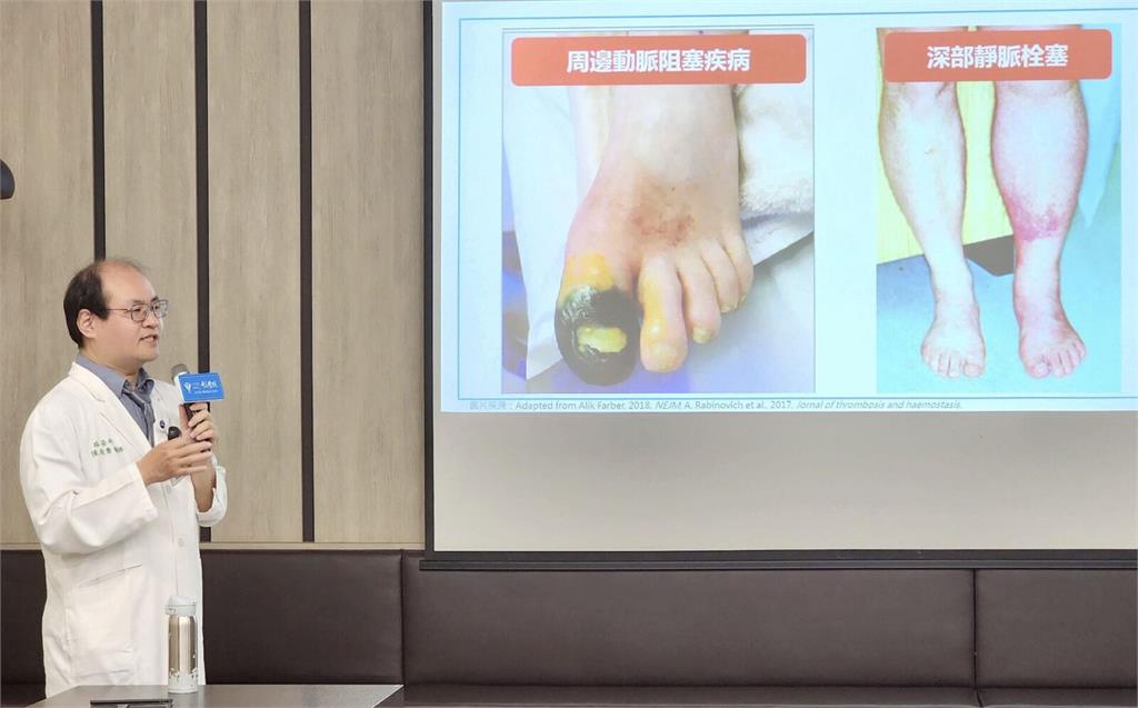 二年3度送醫!蜂窩性組織炎難甩 「一招」復發率8成降至3成