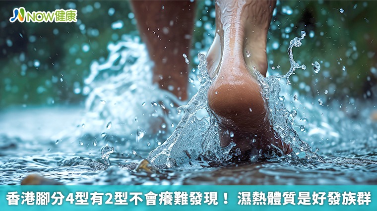 香港腳分4型有2型不會癢難發現！濕熱體質是好發族群