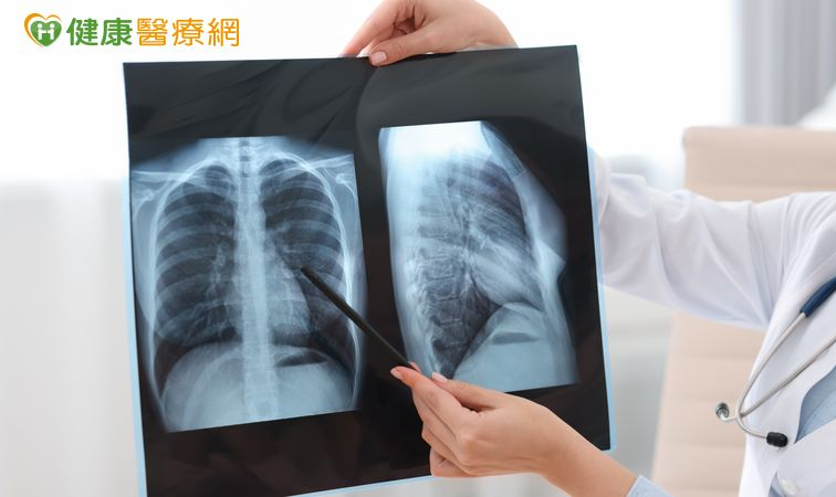 晚期肺癌治療進入組合療法時代　醫：第一線治療策略攸關後續布局