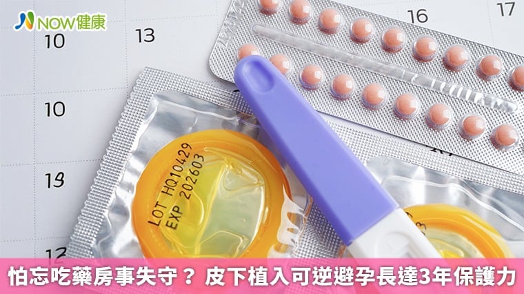 怕忘吃藥房事失守？ 皮下植入可逆避孕長達3年保護力