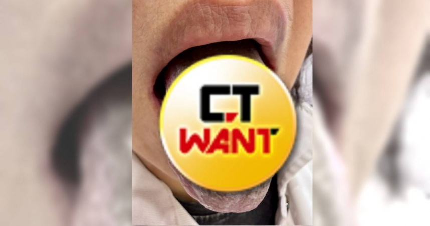 罹牙周病狂灌漱口水！每天6次慘變「黑舌」整條毛茸茸　畫面超驚悚