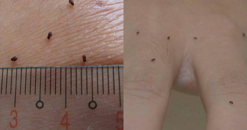 鏟子超人注意！當地人示警帶1物超重要：沒有土生土長大的沒免疫