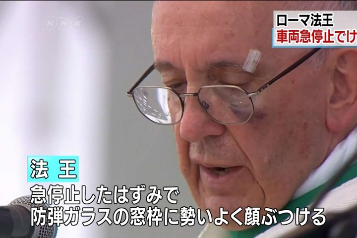 教宗方濟各訪哥倫比亞  車子急煞撞傷臉