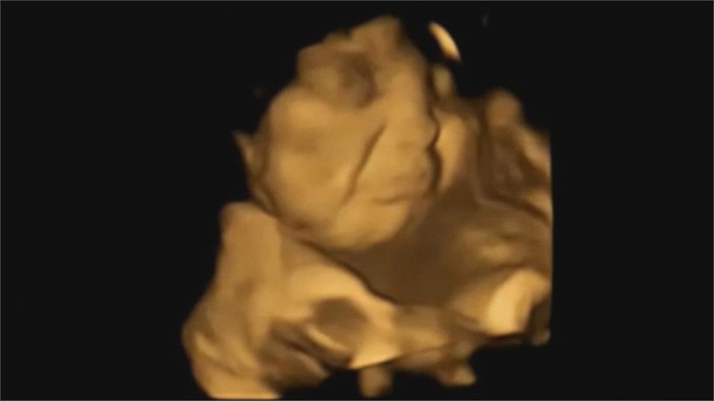 胎兒也懂吃？英研究證實人出生前就有嗅味覺