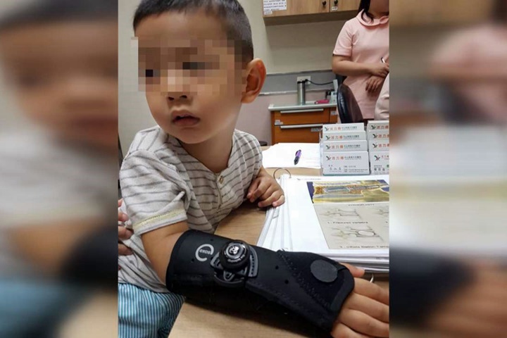 玩溜滑梯骨折 男童「喬骨」裂縫反變大