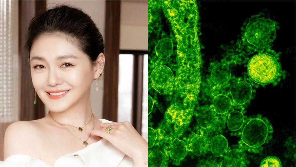 大S病逝日本「流感、感冒怎分辨」？醫列3關鍵曝「最有效預防措施」